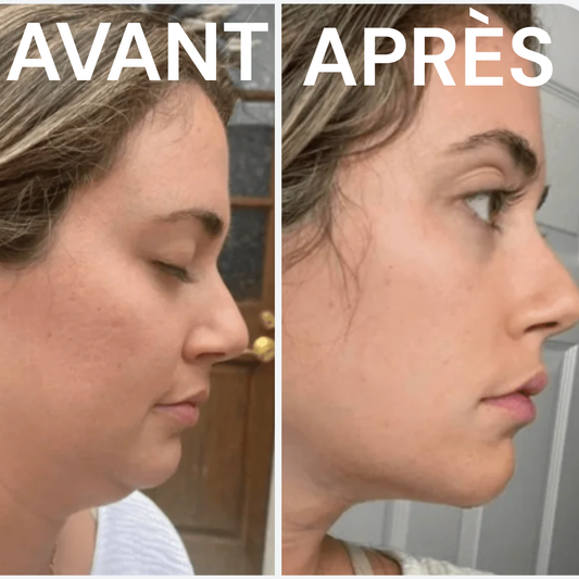 Brosse lymphatique Lift & Glow