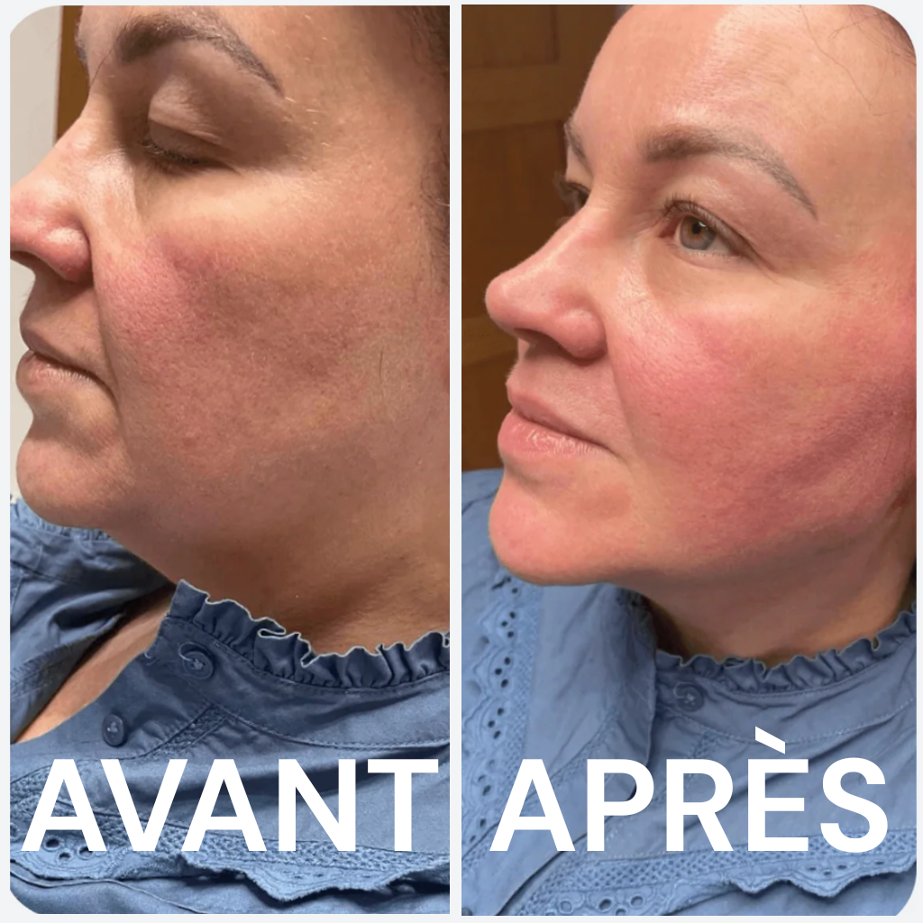 Masque Éclat Liftant Raffermissant